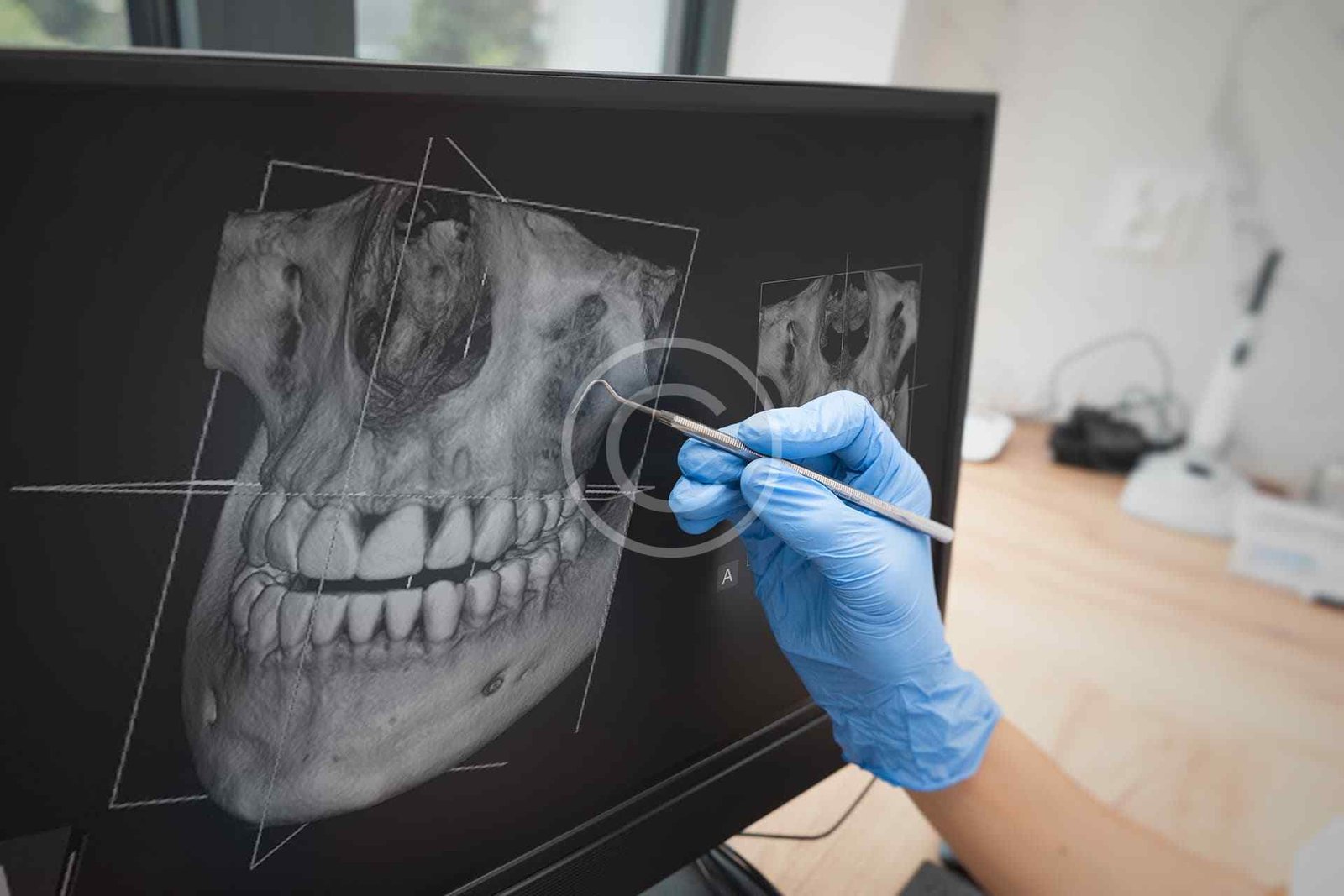 3D imaging